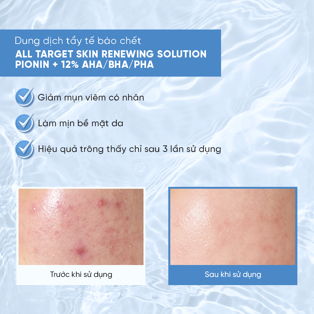 Hiệu quả khi sử dụng Dung Dịch Tẩy Tế Bào Chết All Target Skin Renewing Solution