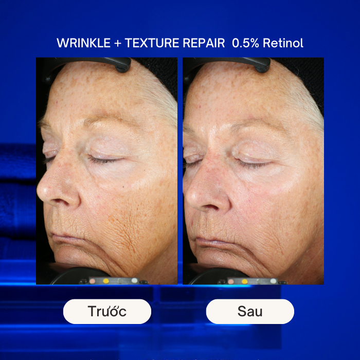 Hiệu quả của Kem chống lão hóa Zo Health Wrinkle + Texture Repair 0.5% Retinol